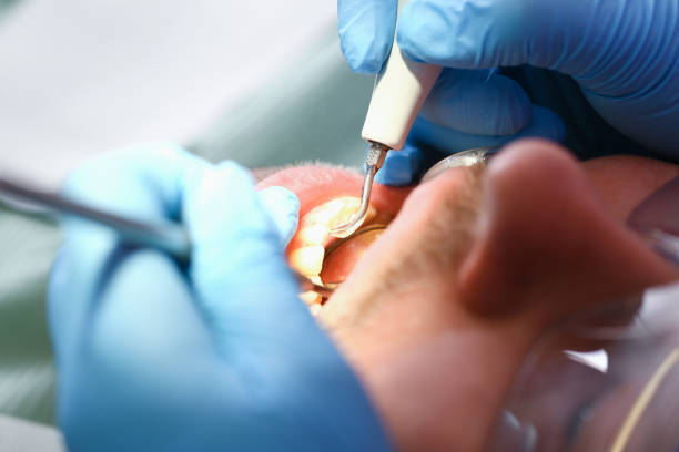 Best Emergency Dental Extractions in Palmyra, WI